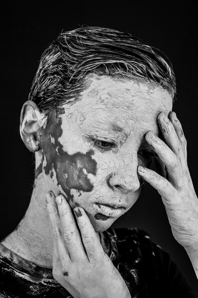 デリケートゾーンの色素沈着の原因とは何ですか？