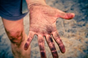 生理後に下着が汚れが増えるのはなぜ？